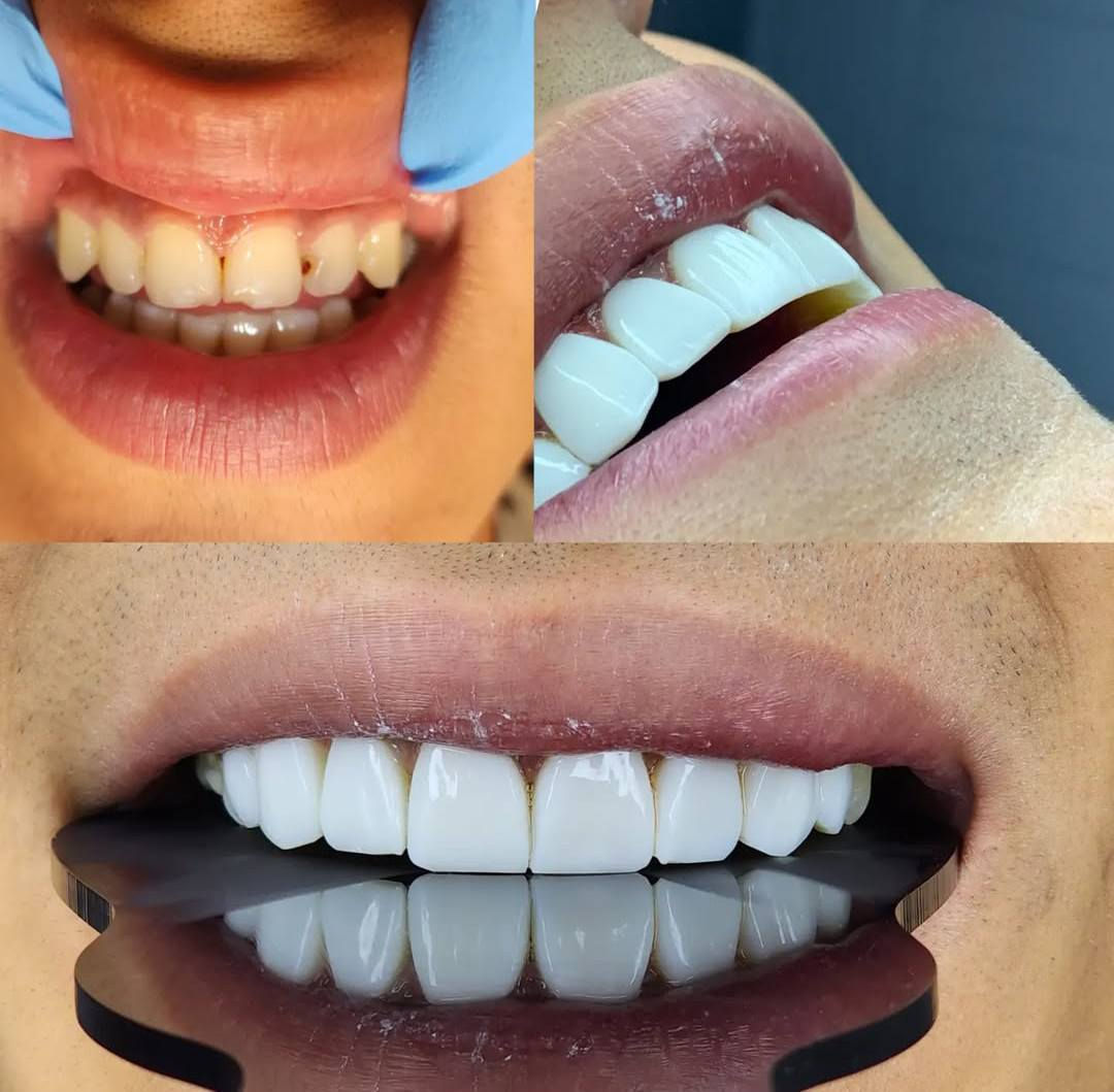 "ابتسامة ولا أروع 😍✨ زورونا وخلي الكل يشوف الفرق!"

عيادة دكتوره هند الحسيني🦷

الامين -تقاطع الزهور-شارع المهداوي-فوق 📍صيدلية غزوان باسم طابق2
***********للحجز والاستفسار📲
