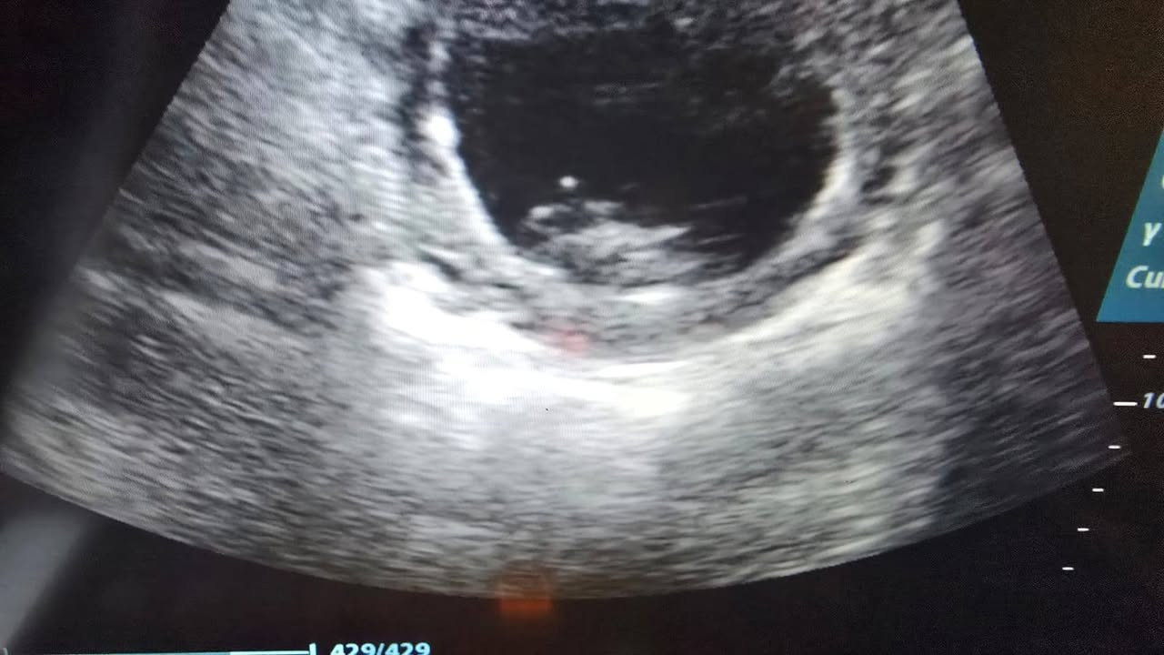 يوم جمعه مبارك في العيادة ❣️ 
فقط صباحا ثلاث حالات حمل بعد عقم طويل

اول حاله حمل بعد 8 سنوات
ثاني حاله حمل بعد 5 سنوات مع ظهور النبض 
ثالث حاله حمل بعد 3 سنوات 
😍😍
عيادة الدكتورة وفاء الفتلاوي 
شارع الدغاره مجمع صيدليه رؤى الحميداوي 
***********
