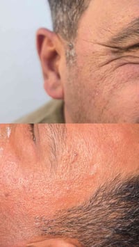 بوتوكس • عروض وجه • حي الرشيد