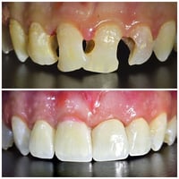 للاستفسار 07885139490