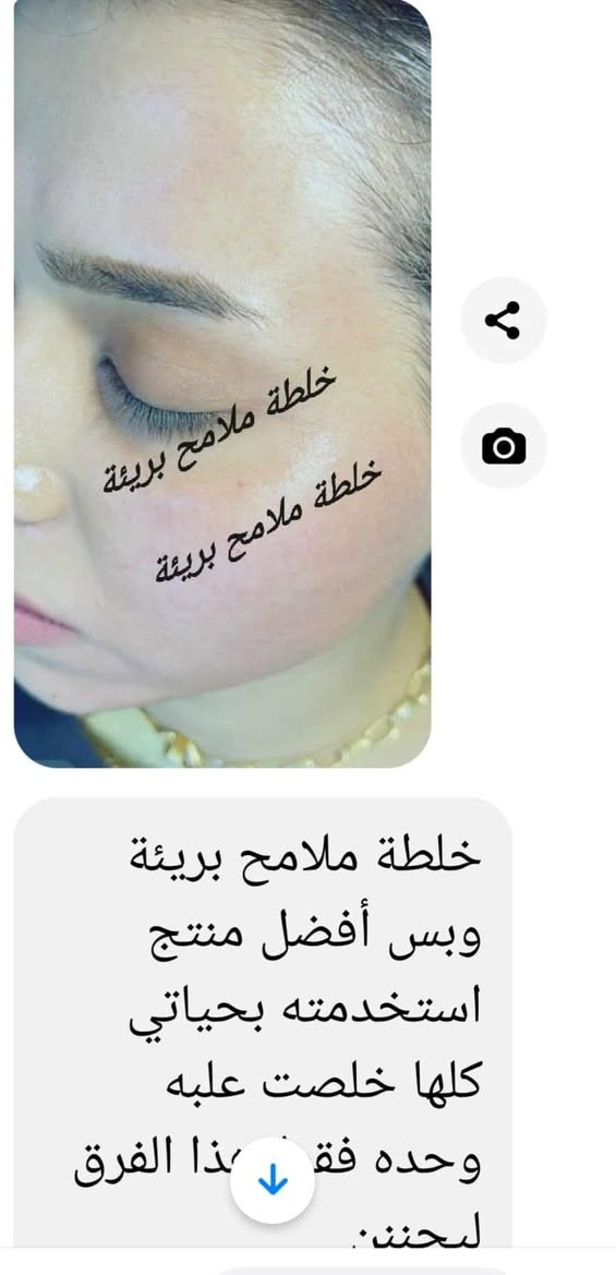 خلطة ملامح بريئةbrend M&B براندي خبيرة البشرة تبـᘓ᭄ـاࢪك _بديع🧑‍⚕️🩺
التجربة خير برهان 🌹المصداقية أولا 
نتائج ممتازة وبوقت قصير جدا وتختلف من شخص إلى اخر حسب حالتكم  
تركيبة ولا أروع  وبمكونات جدا ممتازة وفعالة أمانة الله ورسولة خاليا من الكرتزون🦋


**إذا كنت صاحب هذا الإعلان وتريد حذفه لأي سبب، رجاءا أرسل رسالة إلى الدعم الفني**