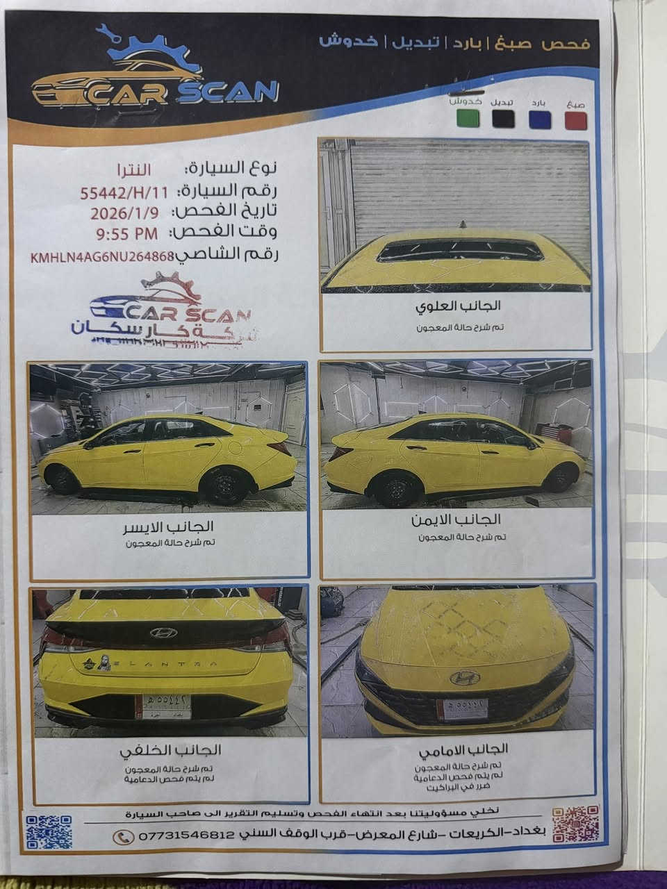 للبيع النترا وارد امريكي موديل 22فول مواصفات فتحه بصمه تشغيل عن بعد كشنات كهربائي لايت زنون بلاد لد امامي خلفي قياده ذاتيه رادار جانبي امامي خلفي فول فول كير ايتي محور وكاله سياره كفاله عامه ماعده الدعاميه حادثها بس دعاميه فقط المكان كربلاء رقم الهاتف***********
