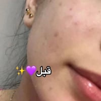 كريم لارا • نتايج • فديت