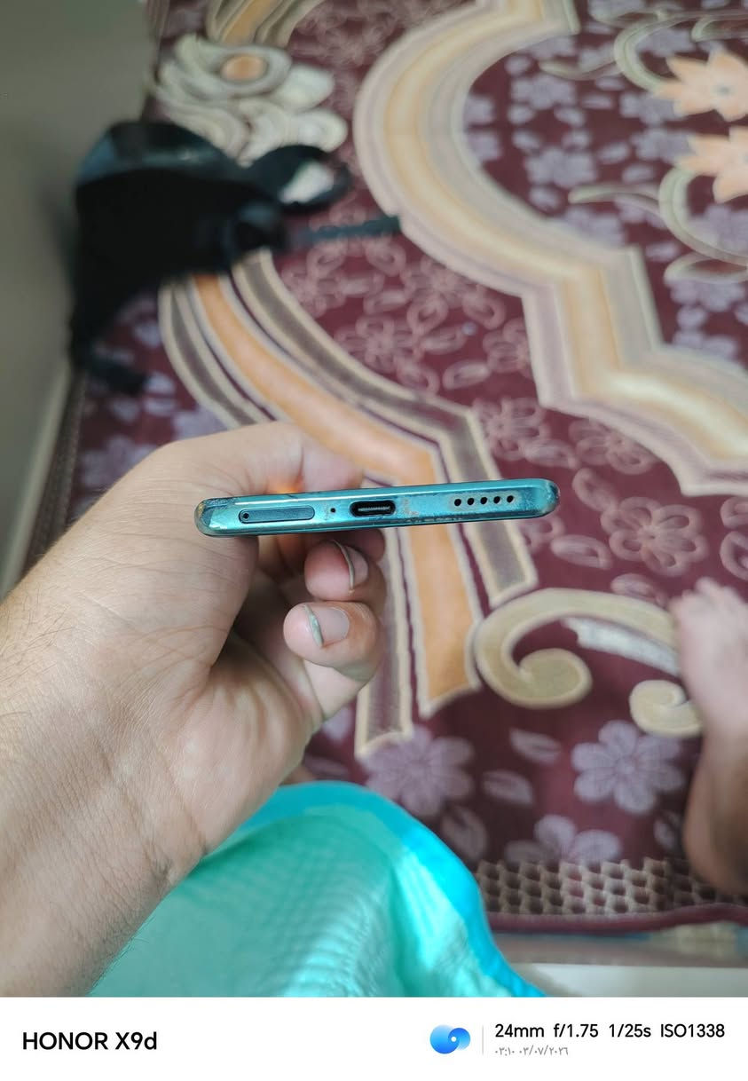 السلام عليكم تلفون هونر x9a
ذاكره ١٢٨ بي خط بل شاشه بس شغال مابي شي جهاز مامئثر لخط كلش جاهز نضيف حيل تعال افحصه وشوفه
مراوس فقط بايفوان ١١ عادي او ١٢ عادي واطي فرق


**إذا كنت صاحب هذا الإعلان وتريد حذفه لأي سبب، رجاءا أرسل رسالة إلى الدعم الفني**