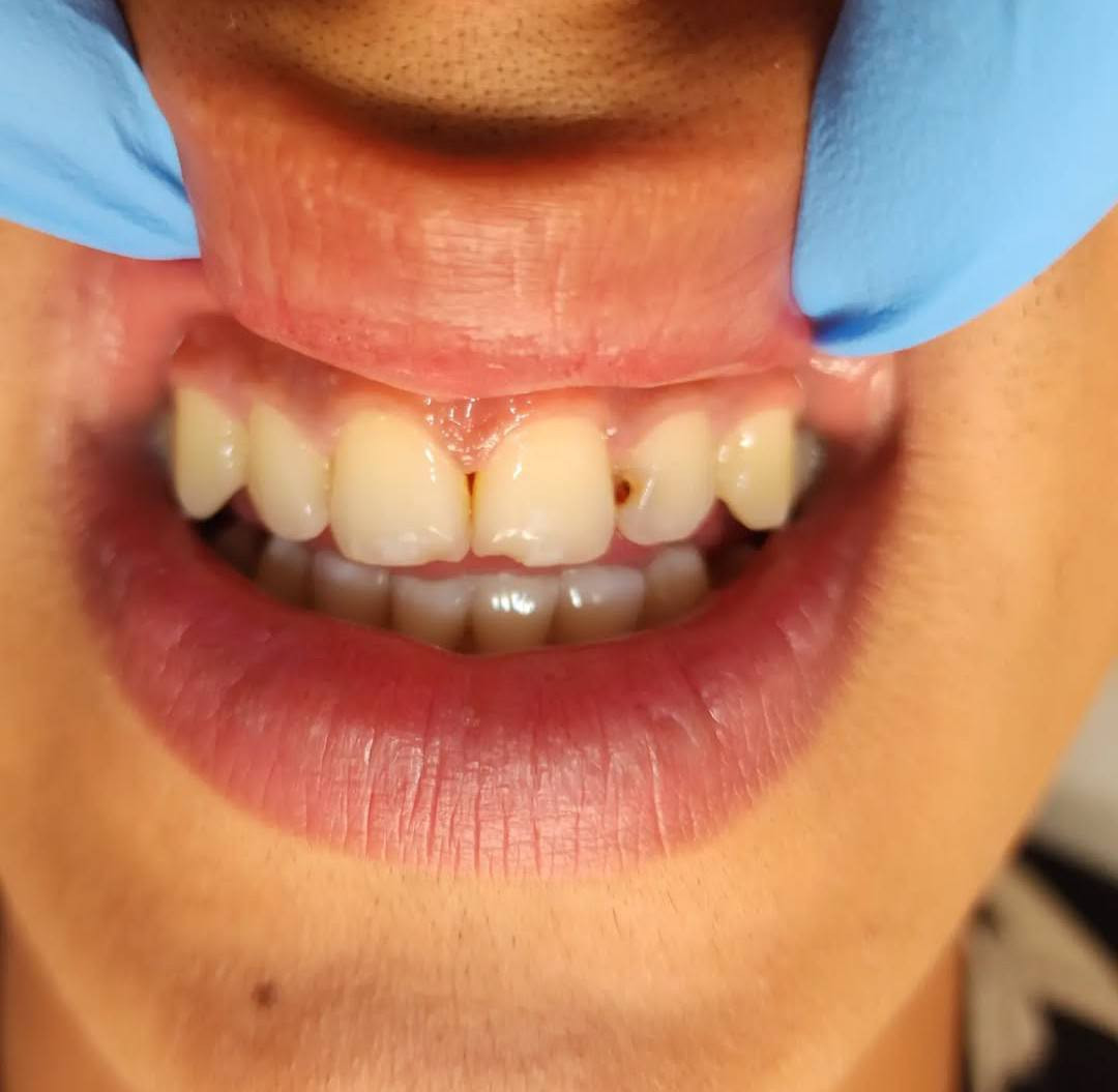 "ابتسامة ولا أروع 😍✨ زورونا وخلي الكل يشوف الفرق!"

عيادة دكتوره هند الحسيني🦷

الامين -تقاطع الزهور-شارع المهداوي-فوق 📍صيدلية غزوان باسم طابق2
***********للحجز والاستفسار📲
