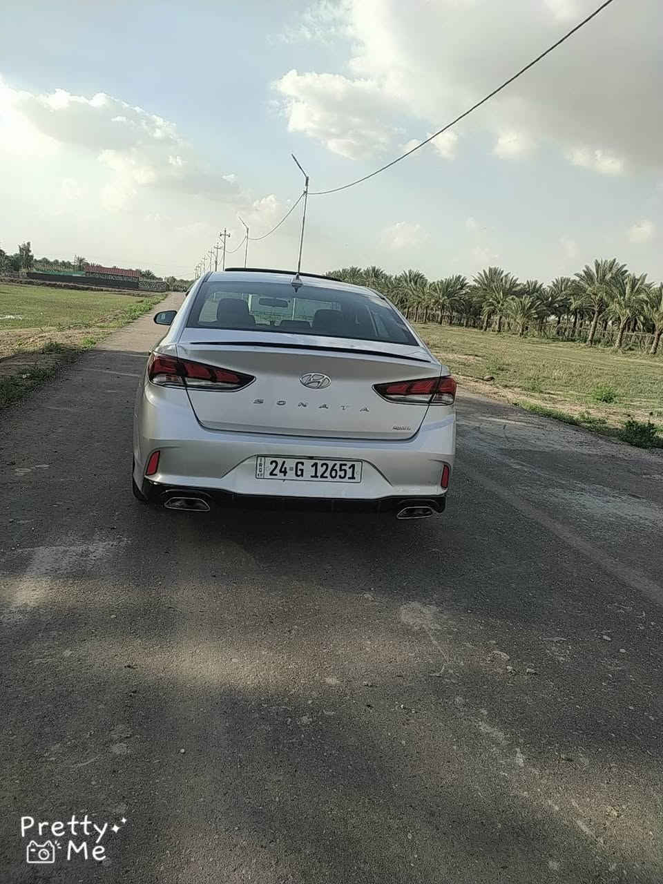 ياالله سلام عليكم سوناتا موديل 2018فول مواصفات sport أمريكي حادث جاملغ وبنيد رقم شمالي سنويه جديده ل2031هزه جديده                         تريد تحويل أو وكاله اني حاضر.    السعر 128وبيه مجال للشراي للاستفسار أتصل ***********.           ***********
