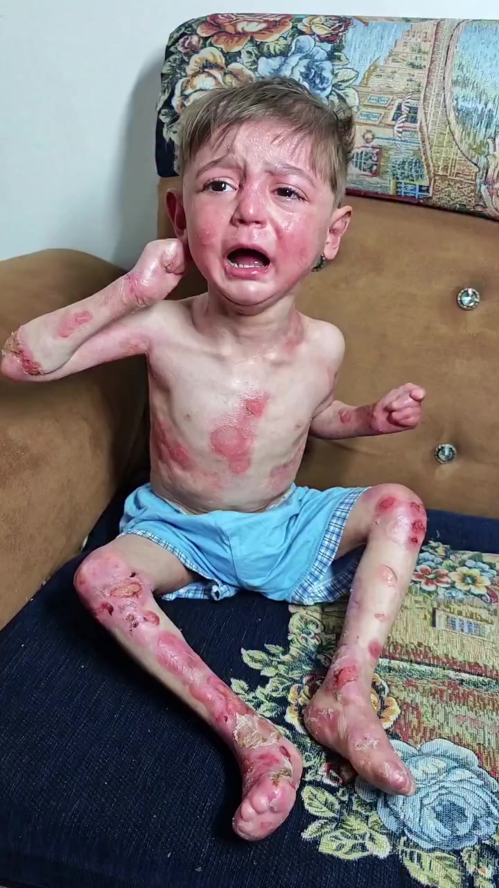 انقذوا حياة يوسف الطفل يوسف مصاب بداء الفقاع الجلدي وهو بحاجة إلى خطة علاجية متقدمة تقي جسده من هذا الانحلال وتقلل الأضرار لديه قدر الإمكان 
للمساهمة والتبرع له عبر المنافذ الاتية:
1️⃣تحويل الرصيد اسياسيل 
***********
2️⃣لتحويل الزين كاش
***********
3️⃣ماستر كارد الرافدين
تحويل ماستركارد 7113670900
تحويل سوبركي ***********

PayPal4️⃣
asal1994asal@yahoo.com

5️⃣للتحويل عبر 
مصرف العراق الاولfib
فيست باي
  اسيا باي
 اوطيف باي
 عبر الرقم ***********
للتواصل عبر الواتساب ***********

6️⃣كذالك تكَدرون تساهمون عن طريق ارسال صورة رصيد نوع اسيا عبر الخاص.

7️⃣وللتبرع من خارج العراق رابط منصة الكوفاندمي مثبت في بايو الحسابي.
⭕الخاص مفتوح الأسئلة والاستفسارات جميعاً

📌ارجوا مشاركة المنشور على صفحاتكم المحترمة كي يصل الى اكثر عدد ممكن وجزاكم اللّٰه اجر ناقذها.

#شارك_المنشور
#العراق #بغداد #اكسبلور #تصميمي #iraq
