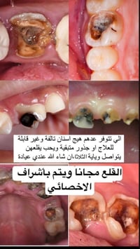 المحتاج قلع عنده مثل هذه الحالات في الصورة يتواصل على الخاص او واتساب ...