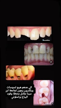 علاج مجاني تحت اشراف كادر طبي متخصص  الخدمات المتوفرة : 💬فحص الاسنان 💬...