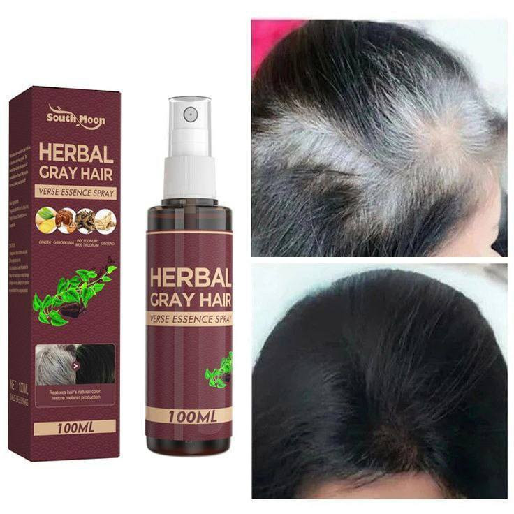 بخاخ HERBAL GRAY HAIR VERSE ESSENCE SPRAY (بخاخ خلاصة الشعر العشبي للشعر الرمادي).
يغذي الشعر وفروة الرأس بعمق.لاستعاده اللون الطبيعي 
يعزز إنتاج الميلانين.. .
مصنوع من مكونات عشبية طبيعية وآمنة.
يساعد في إصلاح بصيلات الشعر التالفة ويترك الشعر ناعمًا ولامعًا

السعر 15
#يوجد_توصيل_لكافه_المحافظات


**إذا كنت صاحب هذا الإعلان وتريد حذفه لأي سبب، رجاءا أرسل رسالة إلى الدعم الفني**