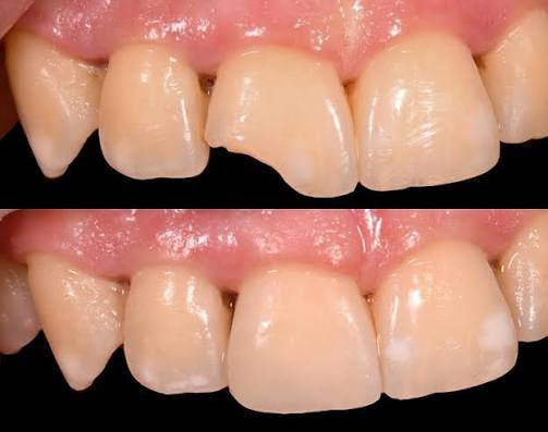 عروضض تكسر الدنيا لاهل الحسينيه وللناس الي تحتاج تسوي تقويم ومحتاره
عيادة السلام التخصصيه توفر لكم 
عرض التقويم فك الواحد ٤٥٠ الف وبالاقساط المريحه لعوائلنا الطيبة وباحسن النتائج 
شغل الطبيب راح ارفقه بالبوست 
*********** للحجز واتساب راسلوهم ومايقصرون وياكم ..
العنوان 
حسينية مدخل ثالث مقابيل بركر موسى 
مجاور صيدليه الطاقه الدوائيه.
