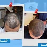 زيت الجوهرة • زيت شعر • زيوت طبيعية • منتجات طبيعية • علاج تساقط الشعر...