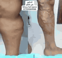 الدكتور علي كاظم
متواجدين اليوم من الساعة 5 الى 9 مساءا

الدكتور علي كاظم
طبيب اختصاص
باطنية-قلبية-صدرية-داء السكري
جراحة القلب والاوعية الدموية
علاج وجراحة الدوالي باحدث الطرق
علاج وجراحة القدم السكري

اوقات الدوام كل ايام الاسبوع عدا الجمعة

للحجز والاستفسار:
***********
***********

العنوان:
بسماية السارع العام المؤدي الى بغداد قرب بوابة بلوك B مجمع نخبة بسماية الطبي مجاور صيدلية ارض الرياحين

#مجمع_نخبة_بسماية_الطبي
#صحتكم_تهمنا
