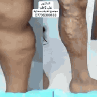 دكتور علي كاظم • باطنية قلبية • بسماية مجمع نخبة