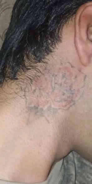 مستعدون لازالة جميع انواع الوشوم القديمة والحديثة بآحدث الأجهزة 
البصرة الجمهورية شارع الاطفاء مقابل ريتاج سنتر قرب حسينية البتول عليها السلام 
*********** البصرة
