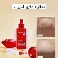 ميديكوب ريد • سيروم مقشر • حمض السكسينيك