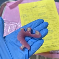 قلع وتعويضات متحركة وتنظيف اسنان تحت اشراف اطباء اختصاص  مستشفى طب الا...