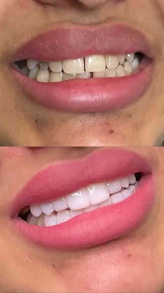 عروض خاصه على قسم الأسنان والتجميل لمدة اسبوع كامل😍
للحجز والاستفسار عبر الخاص او الواتس اب ‭٠٧٧٣ ٣٧٢ ٩٣٠٩‬
