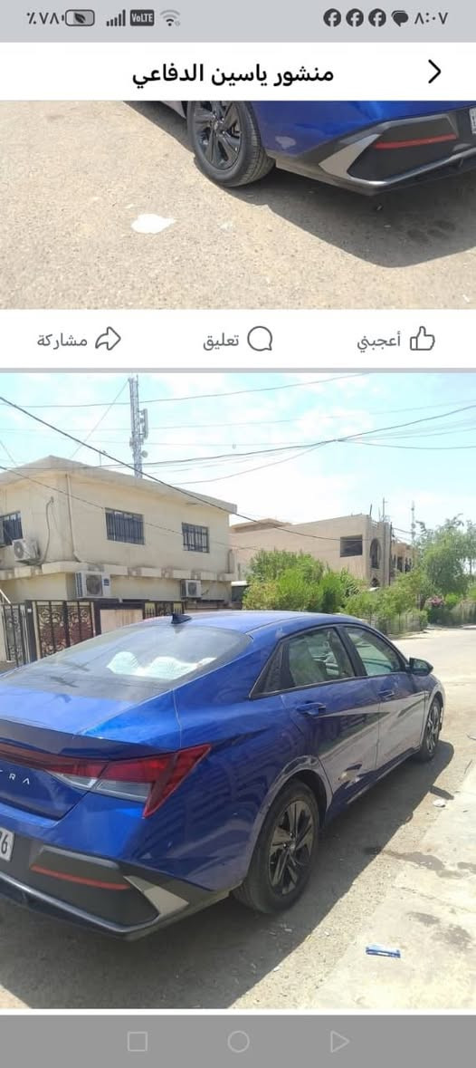 سلام عليكم النتره موديل 2024
امريكي صور حادث مجود بل نشره 
اريد مراوس كي فور لعلوان بغداد 
***********

