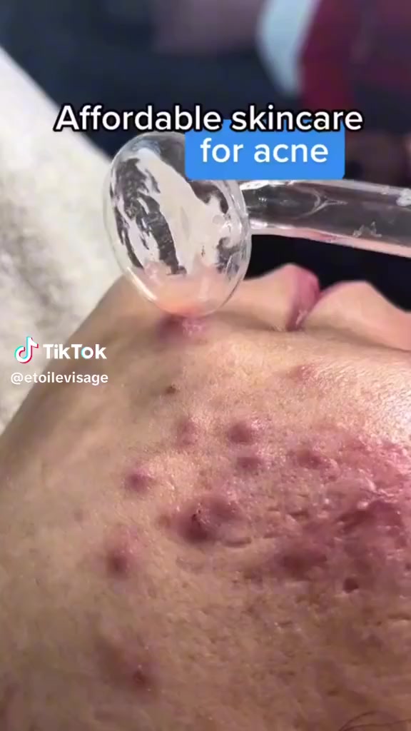 اي وحده تريد من هذا جهاز موجود يمي مكاني كربلاء


**إذا كنت صاحب هذا الإعلان وتريد حذفه لأي سبب، رجاءا أرسل رسالة إلى الدعم الفني**