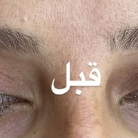 تقنية الفيبروز  تنظيم وترتيب شكل الحواجب بصورة طبيعية  🥰🥰 شوفولي دقة ا...