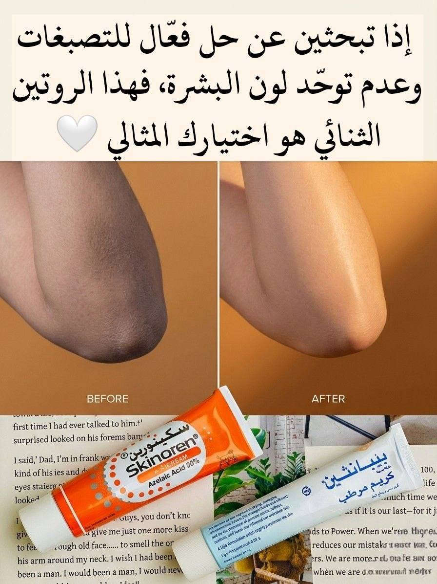 اقوى ثنائي الإزالة التصبغات الوجه والجسم والمناطق الحساسة. 
إذا تبحثين عن حل فعّال للتصبغات وعدم توحّد لون البشرة، فهذا الروتين الثنائي هو اختيارك المثالي 

1️⃣ كريم بيبانثين Bepanthen 
كريم غني بفيتامين B5، يعمل على ترطيب البشرة بعمق ويعالج الجفاف والتشققات. يساعد على تهدئة البشرة وتقليل التهيج، ويخليها ناعمة ومهيأة لاستقبال كريمات التفتيح. استخدامه المستمر يمنحك ملمس حريري ويعزز صحة البشرة بشكل عام، مما يساهم في ظهور نتائج التفتيح بشكل أفضل وأسرع.

2️⃣ كريم Skinoren سكينورين 
يحتوي على حمض الأزيليك المعروف بقدرته على تقليل التصبغات والبقع الداكنة. يساعد على توحيد لون البشرة، يخفف آثار الحبوب، وينظف المسام، بالإضافة إلى تقليل الاحمرار. مناسب للوجه والمناطق اللي تعاني من اسمرار أو تفاوت باللون، ويعطي نتائج تدريجية وآمنة مع الاستمرار.

🇩🇪 كريم بيبانثين 
المنشأ: ألمانيا
🇮🇹 كريم سكينورين 
المنشأ: إيطاليا ✨


**إذا كنت صاحب هذا الإعلان وتريد حذفه لأي سبب، رجاءا أرسل رسالة إلى الدعم الفني**