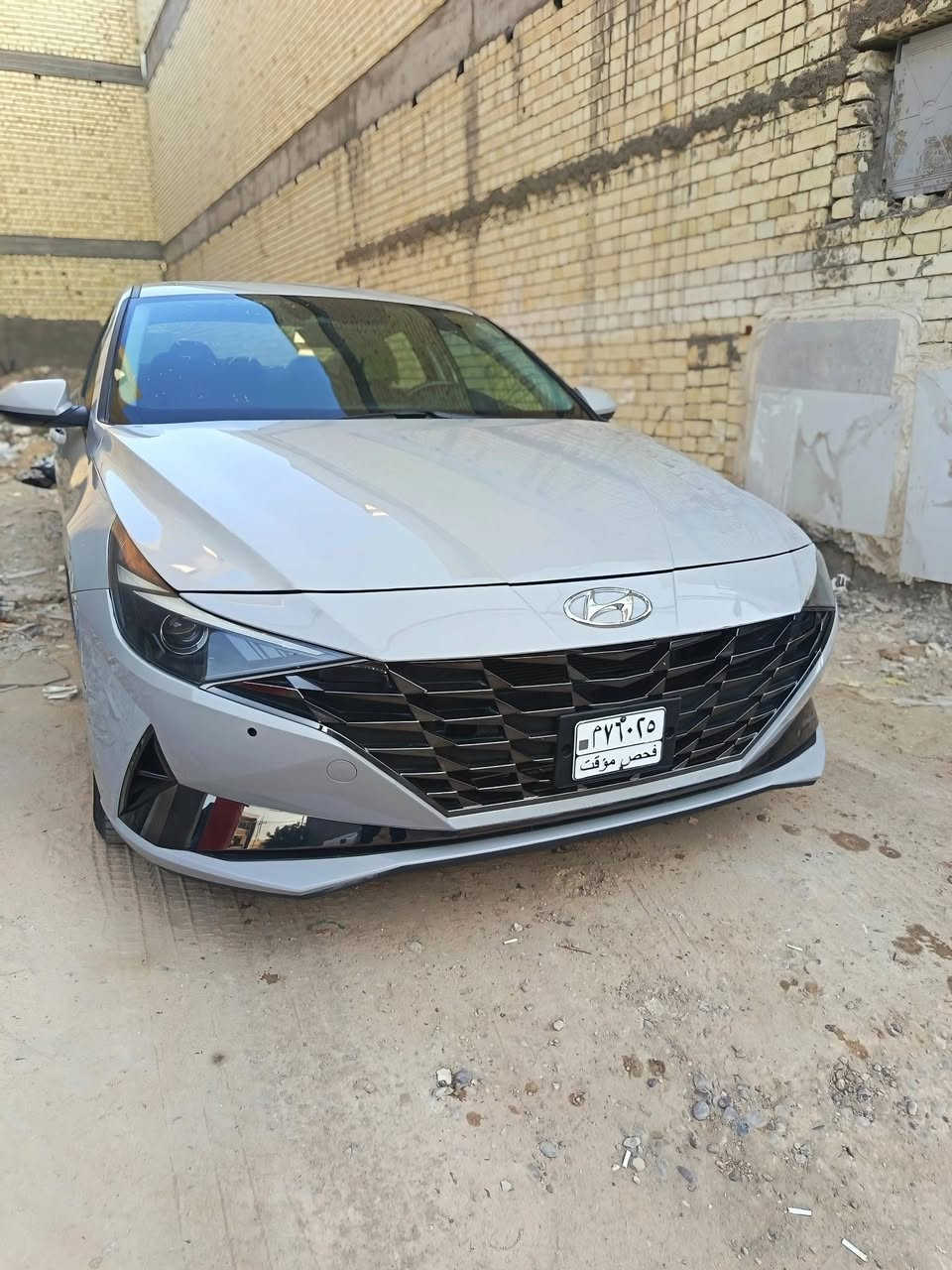 السلام عليكم النترا 2023 وارد كندي صور حادث بل منشور مكينه 2000 دوش سيارة جديد بدون رقم بدون ارباك حادثه يخبل
موصفات تحكم جهتين رادار 3 تشغيل عن بعد بصمه سعره 130 وبيه مجال حك جيه ***********
