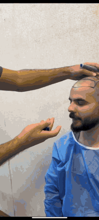 الناس دكول الاصلع ملك الساحه! وانت صدكت ؟!!  #بخطوه وبقرار واحد تتخذه ...