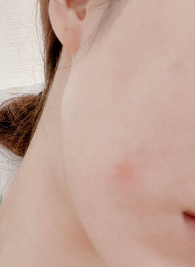 كريم فيفيان + صابونه  الاصلي 💯💯💯
احد اهم افضل المنتجات لتبييض البشرة كريم فيفيان مصنوع من 14 مادة عشبية و 6 فيتامينات

منتج واحد يساعد على حل اهم 5 مشاكل للبشرة . يبيض البشرة - يعالج الكلف - يعالج التصبغات يعالج الهالات التحت العين - يرطب البشرة وتصبح اكثر نضارة

نتيجة الكريم ثابتة ودائمية نتائج حقيقية من اول استخدام بدون آثار جانبية اثناء او بعد ترك الاستخدام بسبب التركيبة


**إذا كنت صاحب هذا الإعلان وتريد حذفه لأي سبب، رجاءا أرسل رسالة إلى الدعم الفني**