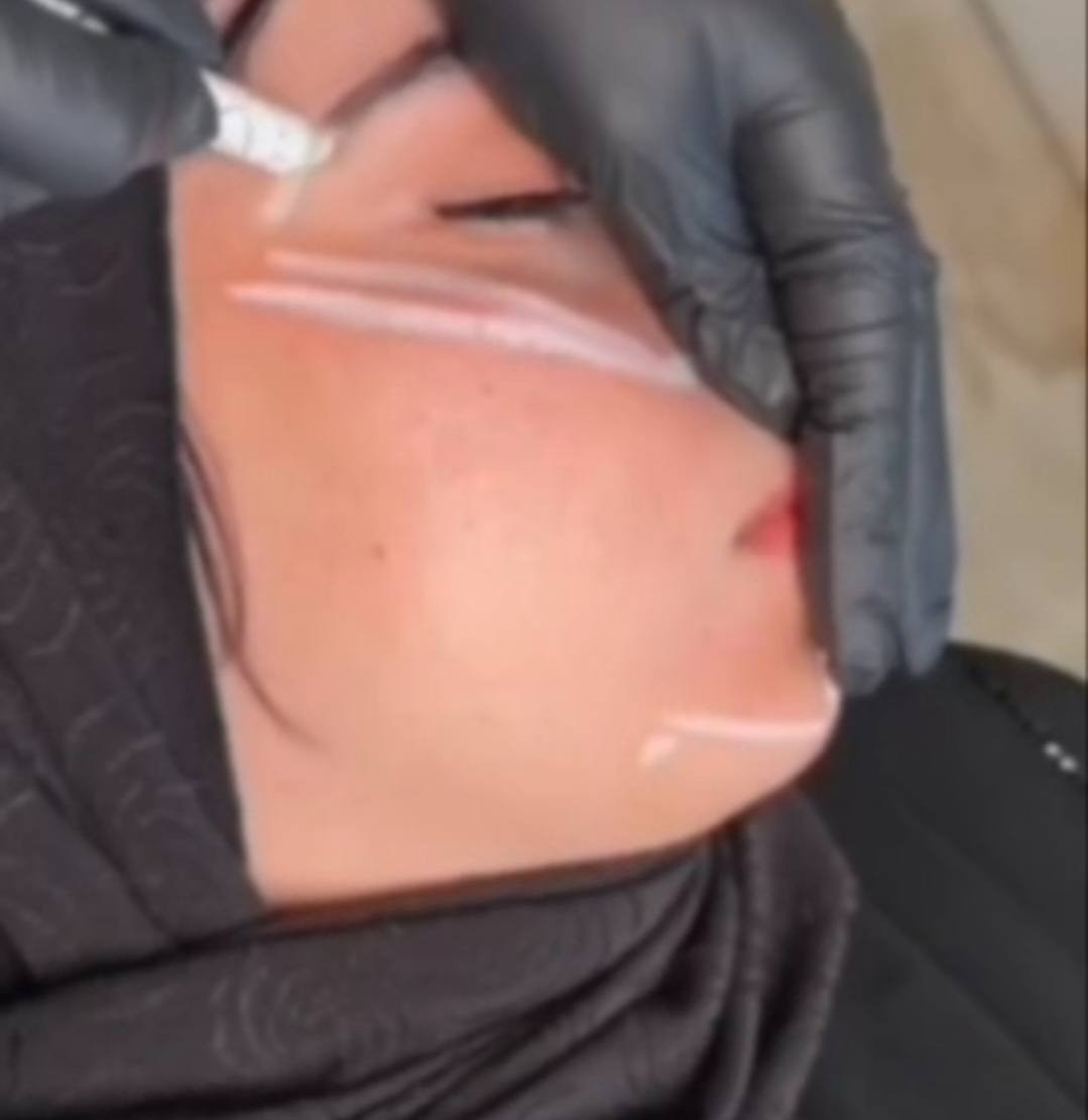عروض خلال فتره العيد
عياده تينا
تنضيف البشره
تغيير الشامل
رسمه شفايف والذقن
راسلونا
***********
