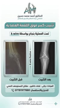 جراحة العظام • مفاصل • كسور • دكتور عظام • عيادة عظام • طبيب عظام • دي...