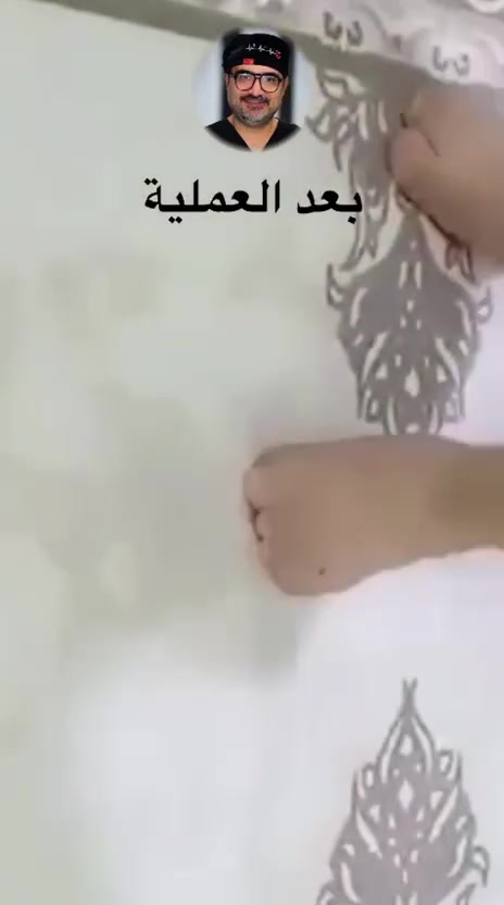 🔴يوم الخميس عصرا من هذا الاسبوع  يتواجد الدكتور حسن محي الدين رشيد 

                         دكتوراه أخصائي امراض وجراحة العظام والكسور والتهاب المفاصل وتبديل المفاصل والروماتيزم والاصابات الرياضية

 اجرى الدكتور حسن محي الدين عملية جراحية لطفل ليس لديه القدرة على المشي او يسقط خلال المشي على الاصابع عملية تطويل الوتر الاكليلي ولله الحمد والشكر من قبل ومن بعد تكللت العملية بنجاح
                                    
 🟢 للحجز والاستفسار  :*********** - ***********

🟢العنوان / مجمع الثقة الطبي طوزخورماتو / شارعة الصاغة / قرب مدرسة يافا الابتدائية
