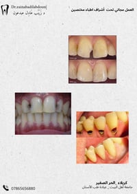 علاج أسنان مجاني • عيادة جامعة أهل البيت • كربلاء الحر الصغير