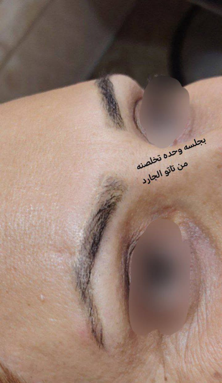 والاستفسار على الواتساب 👈 ***********
عروض مستمره لجميع انواع (آلتہآتہؤ)
وزلاله المسح تہآتہؤ//الغير مرغوب بي 

استغلن العروض  
والاستفسار على الواتساب 👈 ***********

السماوه حي الحسين خلف مطعم بوليفارد----المدربة التاتو ام محمد
صالون ورده؟🥀🥀🥀بغداد 
؟-----------------------------

؟-----------------------------
