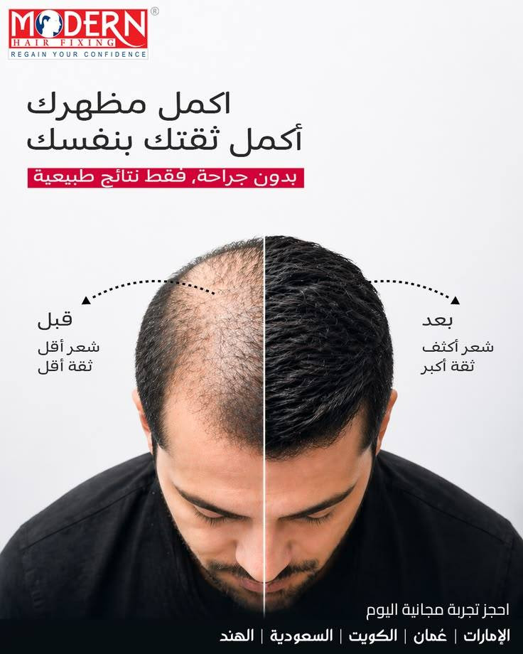 حلمكم حقيقة


**إذا كنت صاحب هذا الإعلان وتريد حذفه لأي سبب، رجاءا أرسل رسالة إلى الدعم الفني**