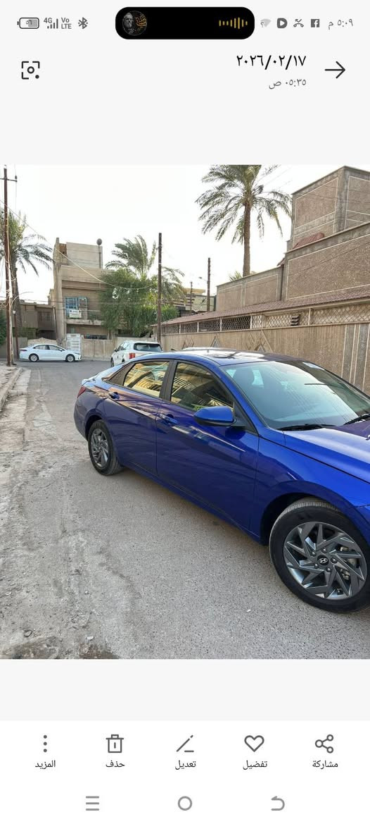 النترا موديل ٢٠٢٤ ماشيه ٧ آلاف حادث خلفي
السعر ١٦٨
***********
