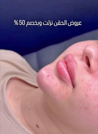 لحكو على عروض الفلر  07715102446