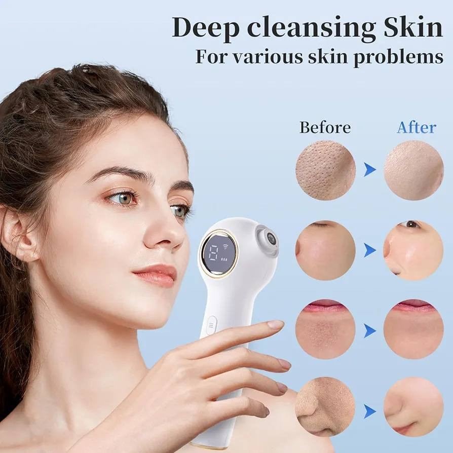 جهاز شفط وازالة الرؤس السوداء مع كامرة السعر 30الف مع التوصيل


**إذا كنت صاحب هذا الإعلان وتريد حذفه لأي سبب، رجاءا أرسل رسالة إلى الدعم الفني**