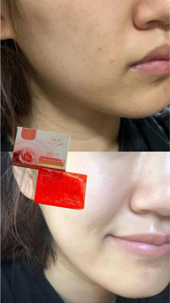 صابون اكليل الغار عشبي اصلي 😍😍 
بخلاصه اعشاب طبيعيه 
يفيد للبشره الحساسه كذلك
متوفر بعده انواع كل نوع وفوائده🥰🥰
صابون لبان الذكر 
صابون  زبده الشيا
صابون الكولاجين
صابون حبه بركه
صابون جوز الهند 
صابون البابونج
صابون الورد 
صابون الكركم وعرق السوس

#توصيل_كافة_المحافظات


**إذا كنت صاحب هذا الإعلان وتريد حذفه لأي سبب، رجاءا أرسل رسالة إلى الدعم الفني**