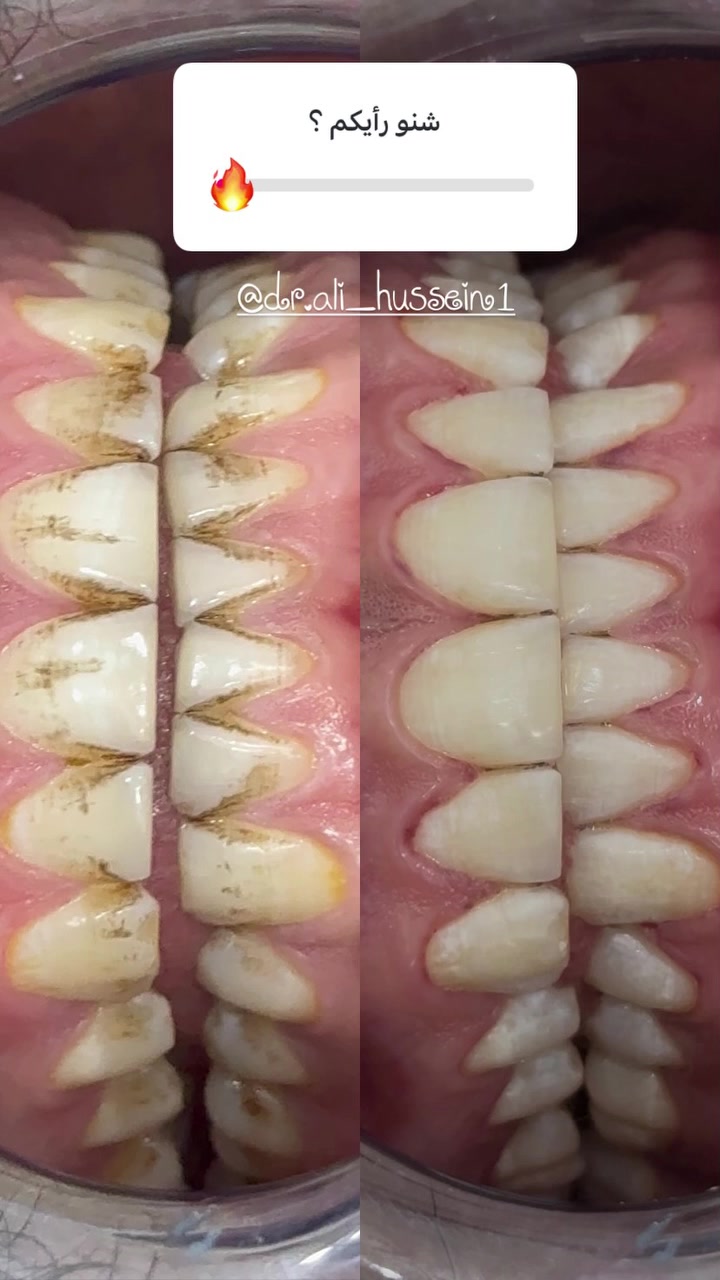 عيادة الغدير لطب وتجميل الأسنان 
قضاء الفجر / قرب فلكة الصدرين/ مجاور صيدلية علي هاشم الموسوي 
***********
