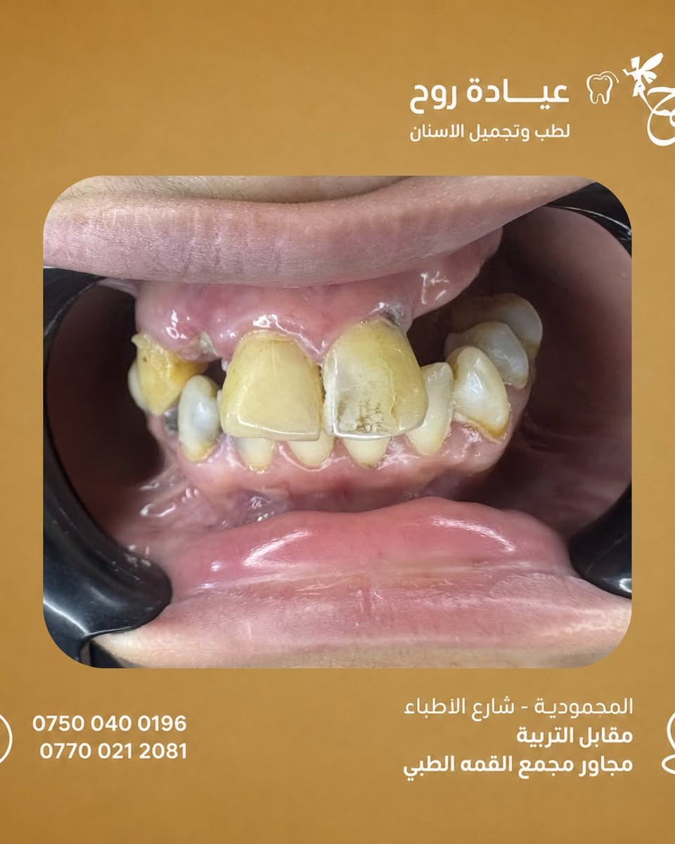 د. كتوره د.زهراء صادق  عيادة روح لطب وتجميل الاسنان
