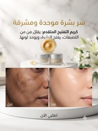 تبييض • تصبغات • توصيل العراق