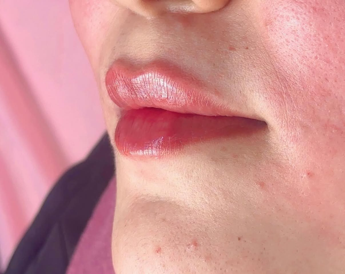 #فيلر


**إذا كنت صاحب هذا الإعلان وتريد حذفه لأي سبب، رجاءا أرسل رسالة إلى الدعم الفني**