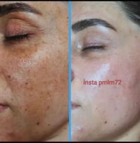 نتيجه أحد الزبونات الي حبت تشارك تجربتها ويانا بعد حصولها على النتيجه ...