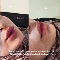 د. هبة عماد • تجميل لاجراحي • ابتسامة هوليود