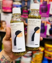 زيت بنت السلطان • تساقط الشعر • داء الثعلب