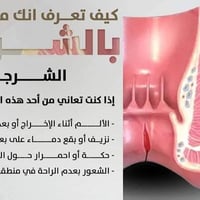 شرخ شرجي • د بسام الدليمي • ابوغريب