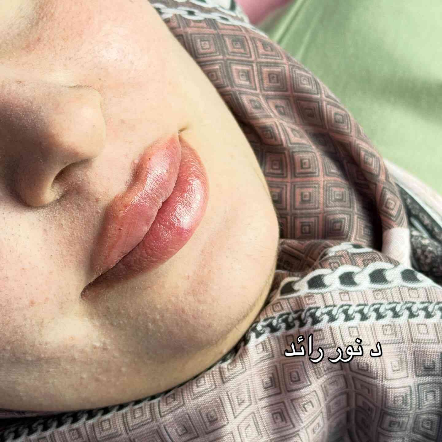 رسمة شفة مرسومة بدقة بأيد الدكتورة نور رائد @dr.noor_almafraji 
#اكسبلورر #فولو #اكسبلورexplore #اكسبلور_explore #فورتنايت


**إذا كنت صاحب هذا الإعلان وتريد حذفه لأي سبب، رجاءا أرسل رسالة إلى الدعم الفني**