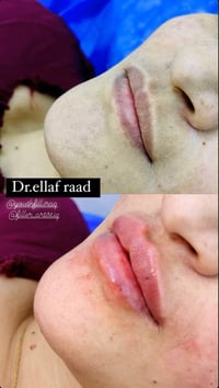 عروض وخصومات هائلة  بمناسبة اافتتاح قسم التجميل   فلر💖 #مجمع ترف كلينك...