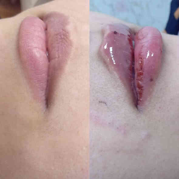 صالون فوفو بيوتي للتجميل
عـروض

عرائس: ميكب وتسريحة ورموش وعدسات وبدلة عرس بـ 150 ألف.

الطالبات: تنظيف VIP ورموش دائمة وبدلتها مفعّلة بـ 100 ألف.

عرض أكريلك: أكستنشن مع تقشير وتنظيف اليد والقدم بـ 35 ألف.

تنظيف بشرة VIP مع إبره الليمونتال مع بدلتها مفعّلة بـ 65 ألف.

صبغ شعر قصير وتحصيل مع معالج تريتمنت بـ 35 ألف.

صبغ شعر متوسط وتحصيل مع معالج تريتمنت بـ 50 ألف.

صبغ شعر طويل وتحصيل مع معالج تريتمنت بـ 65 ألف.

للخريجات: رموش وميكب وتسريحة وأكريلك بـ 65 ألف، وكل طالبتين الثالثة مجاناً.

الموقع: زيونة – تقاطع ميسلون
للاتصال:
***********
***********
